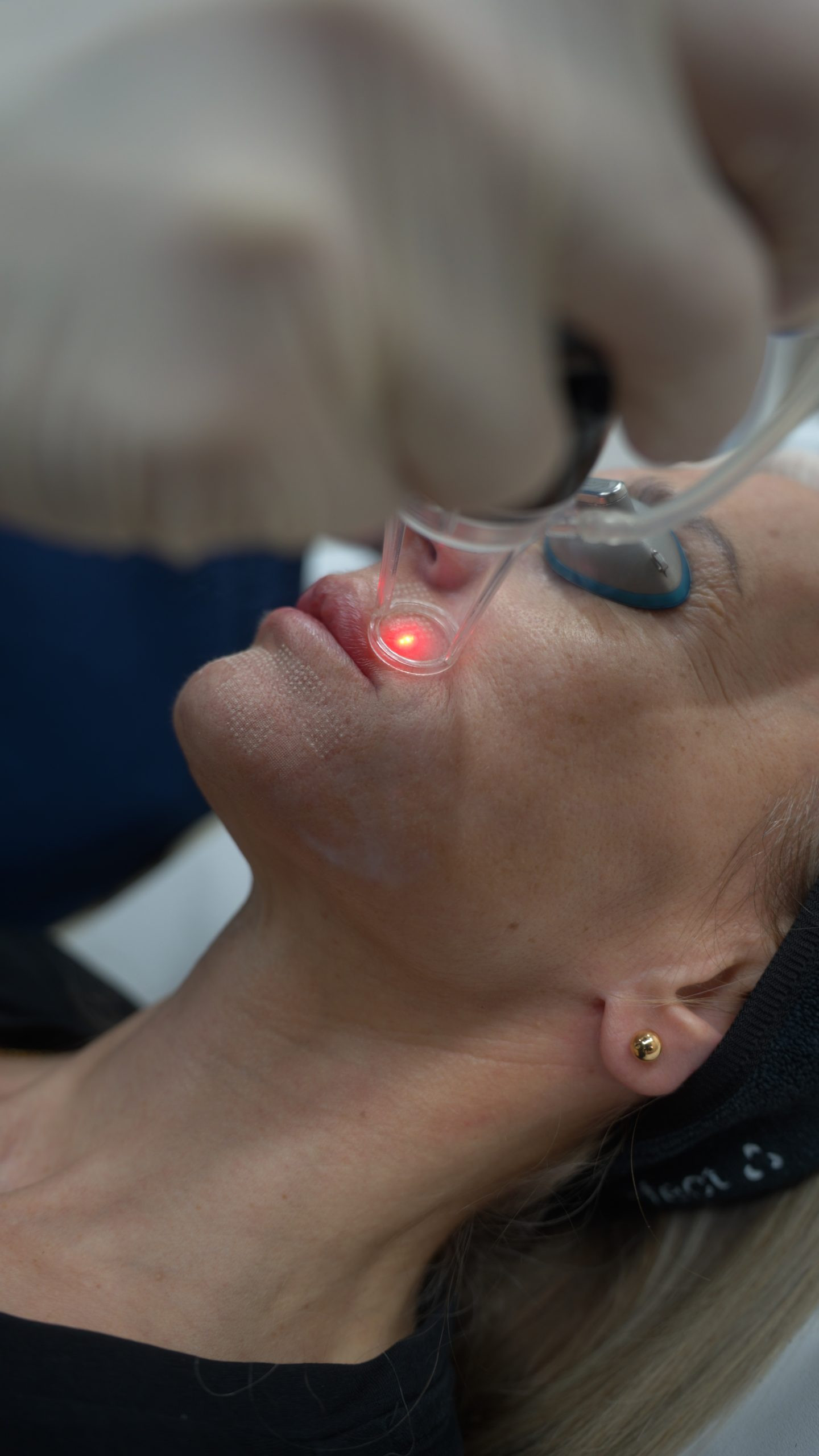 acido-hialuronico_rejuvenescimento-completo