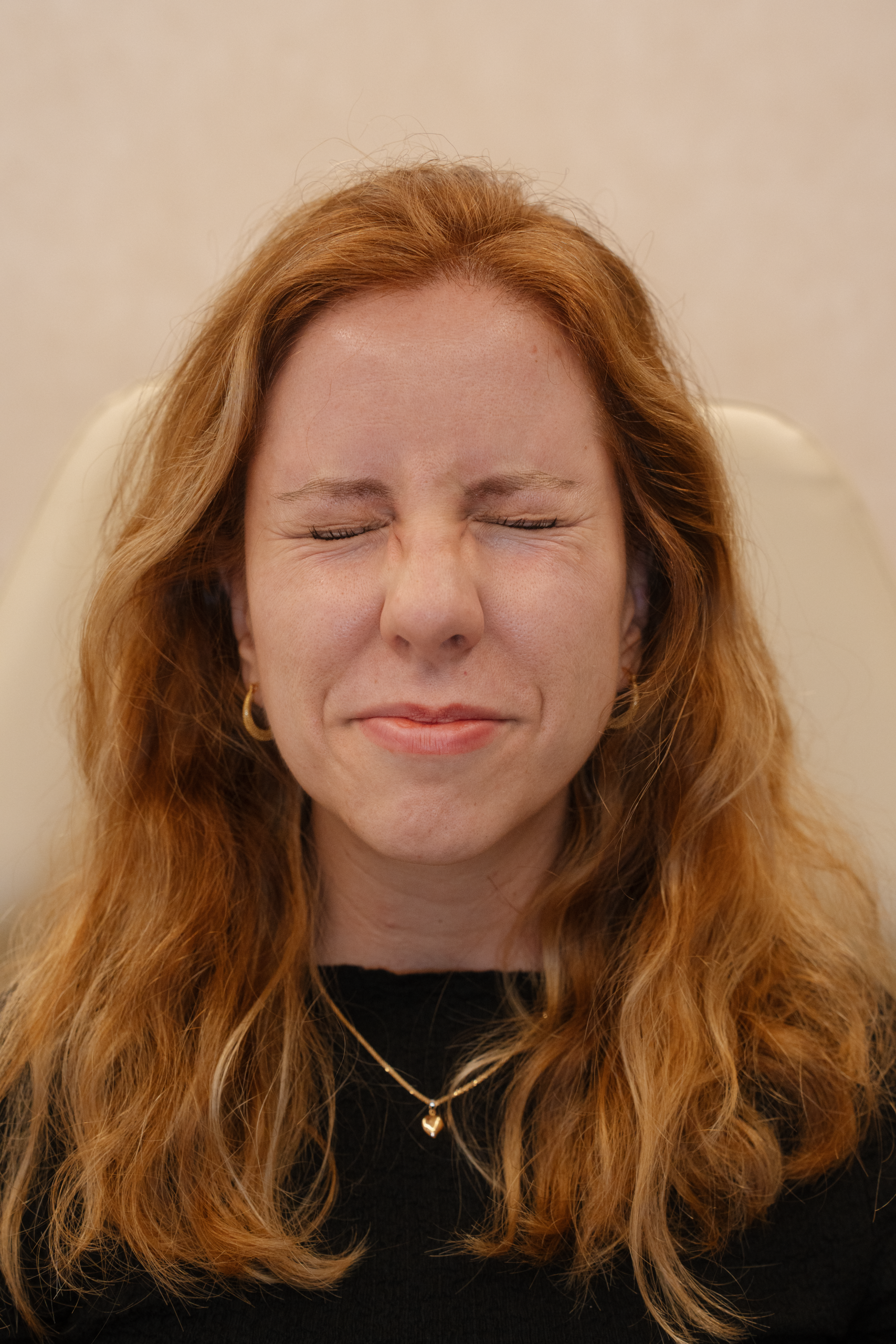 botox_descubra-melhor-tratamento