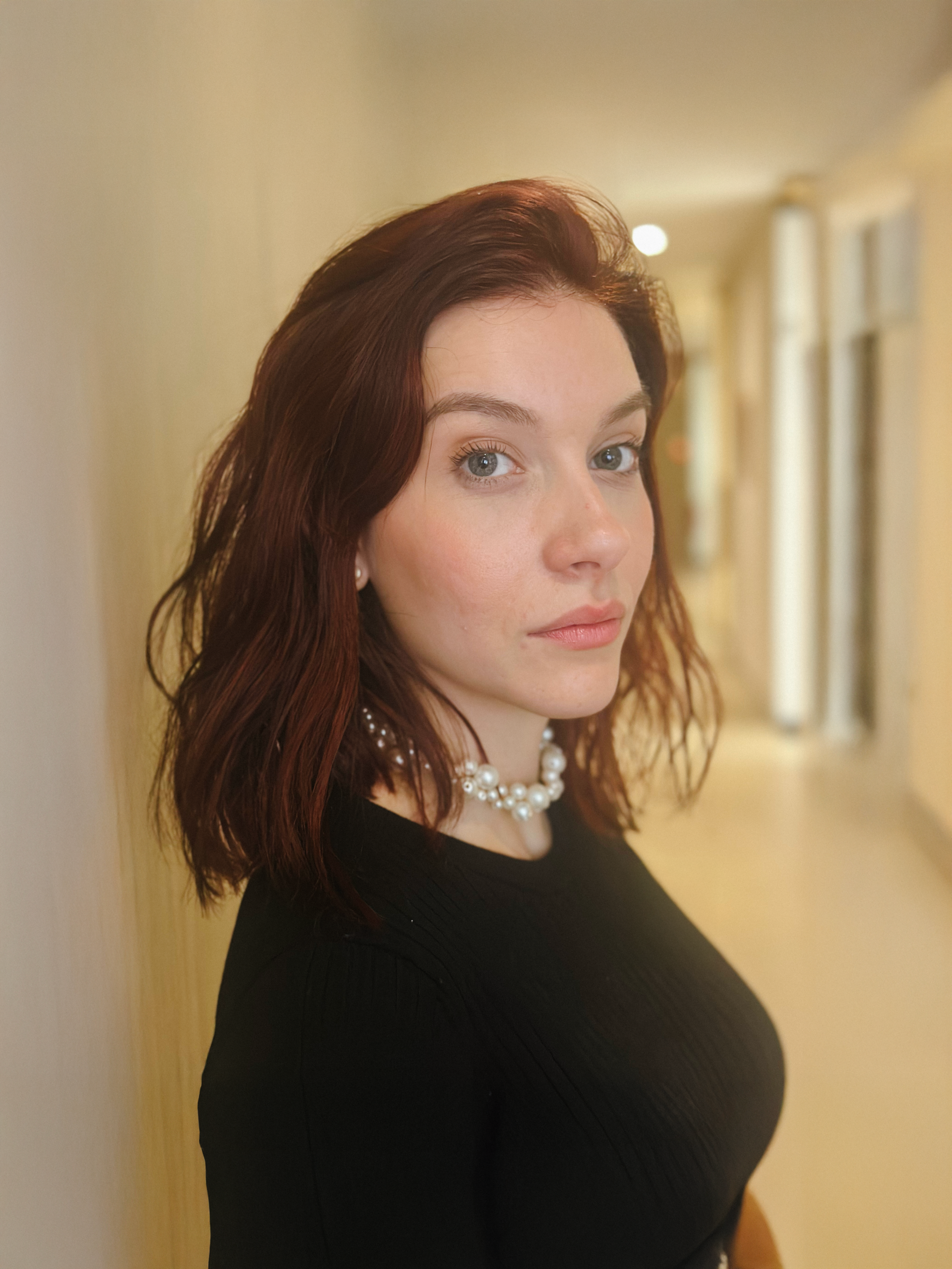 harmonizacao-facial_resultados-naturais