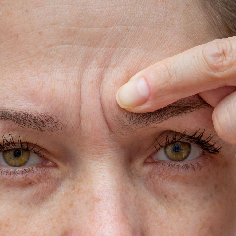 Cropped woman face pointing at wrinkles between eyebrows by finger